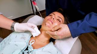 In Office Chin Liposuction [upl. by Lamrej]