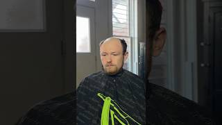 Hair system install Superhairpieces bald toupee hairsystem [upl. by Litt]