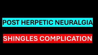 POST HERPETIC NEURALGIA [upl. by Nessim]