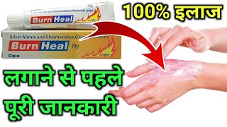 Burn Heal Cream Use in HindiAag se jale ka Dava How to use Burn heal creamBurn Heal kaise Lagayen [upl. by Moises]