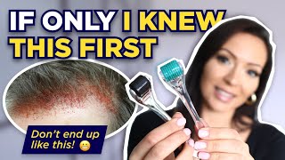 The Dermaroller Watch This BEFORE Microneedling What I wish I knew Before I Started Dermarolling [upl. by Schluter715]