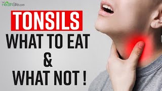 Tonsils Remedies What To Eat And What To Avoid In Tonsils  Sore Throat Treatment [upl. by Godard]