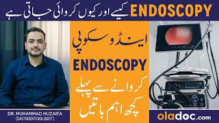 What Is Endoscopy amp How It Is Done  Endoscopy Kaise Hoti Hai  Endoscopy For Various Conditions [upl. by Valenka139]