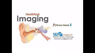 تشريح عظم الصخرة Anatomy of the Petrous Bone [upl. by Araht94]