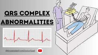 Understanding QRS Complex Abnormalities Causes Symptoms and Diagnosis  ECG cardiachealth 2023 [upl. by Acul711]