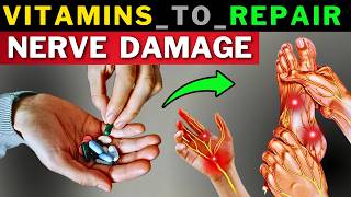 Top 7 Vitamins to Prevent amp Repair Nerve Damage [upl. by Key]