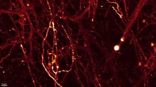 Glutamatergic neurons in the mouse brain sparse labeling [upl. by Siderf901]