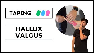 TAPING pour un HALLUX VALGUS [upl. by Themis]