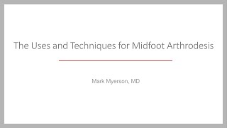 Arthrodesis of the Midfoot [upl. by Nialb834]