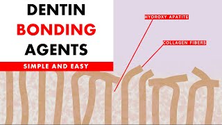 Dentine bonding agents [upl. by Hnah]