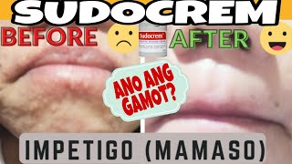 SUDOCREM EFFECTIVE amp PERFECT CREAM FOR SENSITIVE SKIN  Nhors Alde mamaso impetigo skinallergy [upl. by Attelrak]