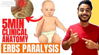 erbs paralysis clinical anatomy of brachial plexus  brachial plexus clinical anatomy [upl. by Mira399]