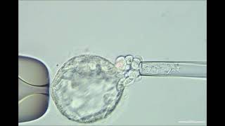 BIOPSIA EMBRIONARIA PARA TEST PGTA [upl. by Moyer850]