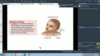 Posterior Triangle of Neck amp Sternomastoid Muscle  Dr Ahmed Farid [upl. by Lidda]