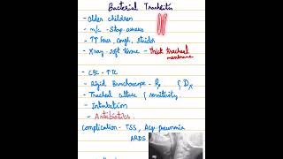 Bacterial Tracheitis ENT amp Paediatrics [upl. by Petrina176]