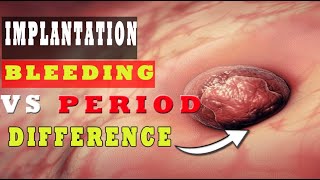 Implantation Bleeding Vs Period – How to Know the Difference 🩸🩸 [upl. by Devina]