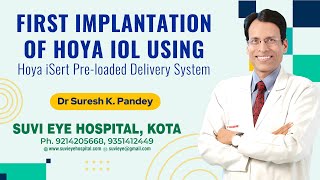 First Implantation of Hoya IOL Using Hoya iSert Preloaded Delivery System SuVi Kota [upl. by Aslin894]