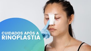 CUIDADOS IMPORTANTES APÓS A RINOPLASTIA O QUE POSSO OU NÃO FAZER [upl. by Luebke219]