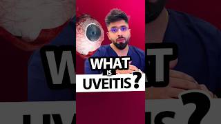 What is Uveitis [upl. by Namad]