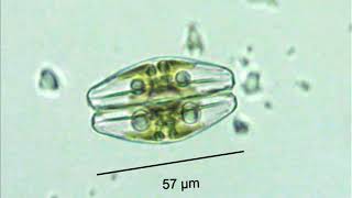 diatoms amphora with oil droplets [upl. by Joela]