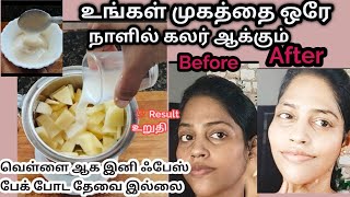 My top best skin whitening cream [upl. by Amyaj]