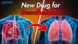 Could Lenvatinib Help Mesothelioma Patients Live Longer [upl. by Randy]