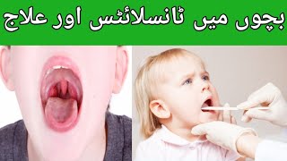 Tonsillitis in children Causes Symptoms and TreatmentGalay ka infection [upl. by Renelle]