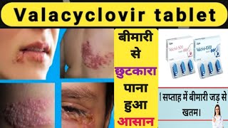 नहीं सहनी पड़ेगी यह दर्दनाक बीमारी  Valcivir 1000 mg tablet uses in hindi  Herpes skin disease [upl. by Nnahaid384]