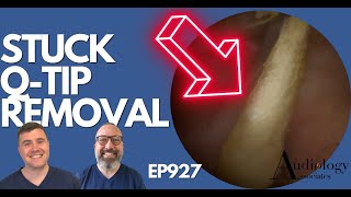 STUCK QTIP REMOVAL FROM EAR  EP927 [upl. by Wallas]