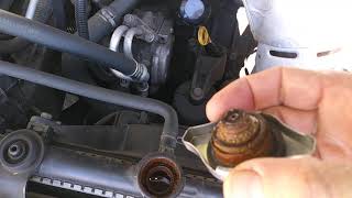 Why My Radiator Hose Is Collapsed [upl. by Lowe157]