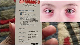 Eye Drops red cause how to drops [upl. by Xer]