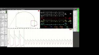 A Cardioprotective Mindset Myocardial Energetics and Ventricular Unloading in Cardiogenic Shock [upl. by Aranaj]