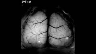 Mouse brain scan at 5x speed [upl. by Dovev]