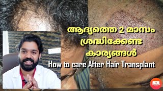 Part 2  ആദ്യത്തെ 2 മാസം ശ്രദ്ധിക്കേണ്ട കാര്യങ്ങൾ  How to care after Hair Transplant ✅ [upl. by Algy848]