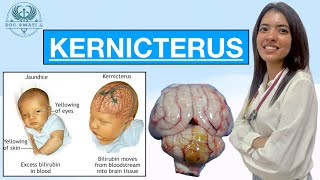 What is KERNICTERUS  How it’s caused  How it affects your body …amp everything you need to know [upl. by Valtin]