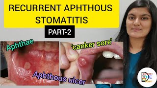 RECURRENT APHTHOUS STOMATITIS RAS PART 2 [upl. by Lim]