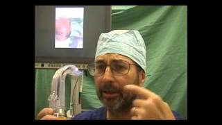 Awake endotracheal intubation with Pentax AWS videolaryngoscope [upl. by Eellac]