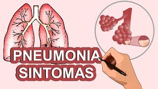 PNEUMONIA SINTOMAS [upl. by Asi]