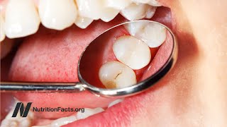 Erythritol vs Xylitol for Preventing Cavities Tooth DecayUPDATE don’t eat See doc note below [upl. by Nnalyrehc]