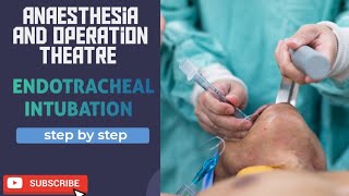 endotracheal intubation [upl. by Bertina430]