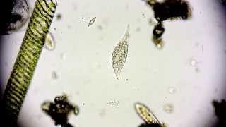 Amphileptus meleagris  Ciliate  Wimpertierchen  Hemiophrys meleagris  microorganisms microscope [upl. by Learsi124]