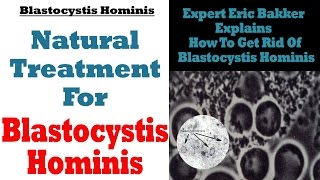 Blastocystis Hominis Treatment Natural Treatment For Blastocystis Hominis  Ask Eric Bakker [upl. by Lateehs]