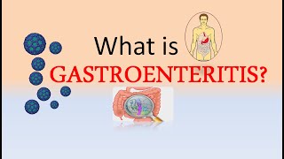 What is Gastroenteritis  ICD10 Codes for Gastroenteritis [upl. by Anileve]