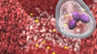 Bacterial infection and host response [upl. by Anoet]