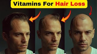 5 Powerful Vitamins To Prevent Hair Loss [upl. by Eedrahc]