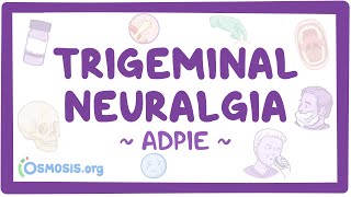 Trigeminal neuralgia Nursing Process ADPIE [upl. by Ariem225]