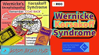 Wernickes Korsakoff Syndrome [upl. by Steiner]