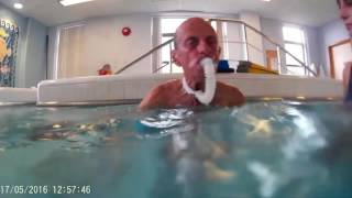 Swimming with an Aquather After Tracheostomy Laryngectomy [upl. by Pacificas443]