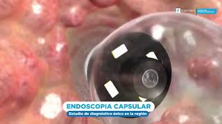 ENDOSCOPIA CAPSULAR [upl. by Anillehs258]