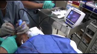 GlideScope Pediatric Airway Rounds Case Study 4 year old Cleft Palate Repair [upl. by Nodla]